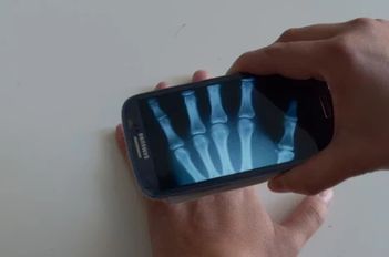 Скачать взломанную рентгеновский Шутки (Мод все открыто) на Андроид